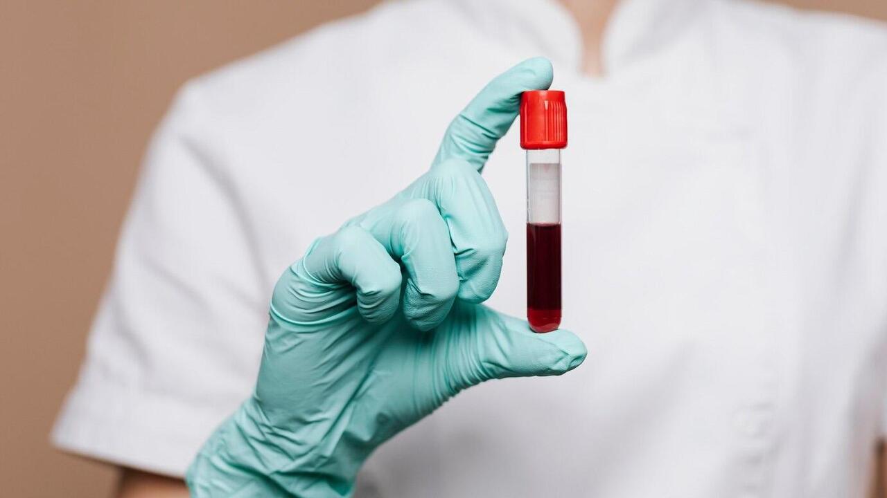 Как правильно сдавать анализ крови